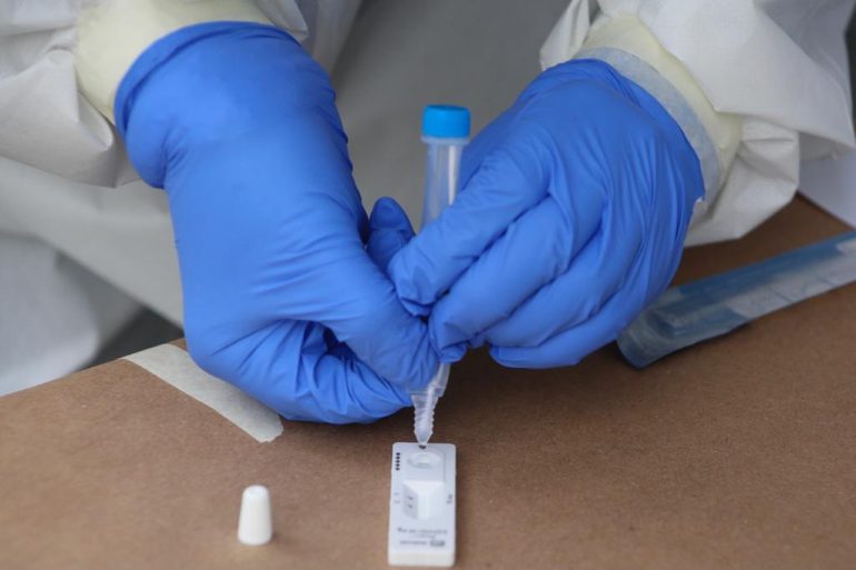 Alertan sobre 9 marcas de pruebas Covid no autorizadas