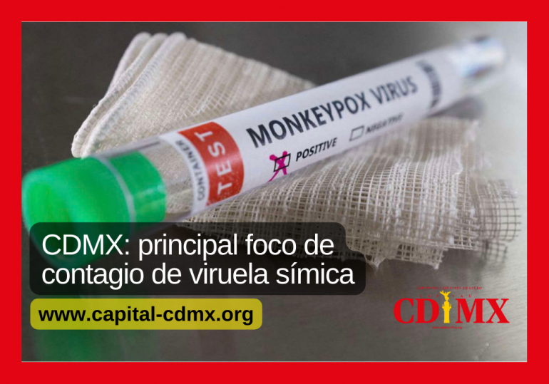CDMX: principal foco de contagio de viruela símica