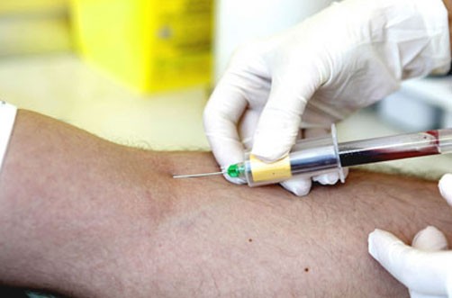 Aprueban en comisiones obligatoriedad de centros de salud para realizar pruebas contra cáncer