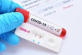 Urgen a Cofepris revisar calidad de pruebas para detectar Covid19