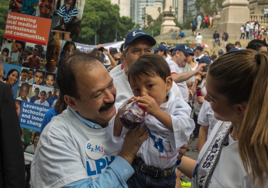 Diario nacen nueve niños con paladar hendido en México