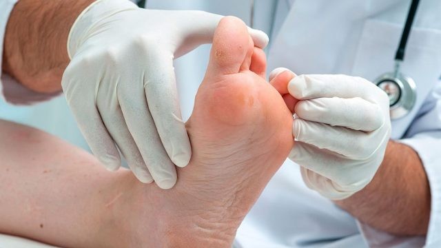 Crean parche regenerativo de piel para pacientes diabéticos en la UNAM