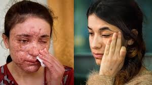 Dan premio de derechos Humanos a sobrevivientes de violencia sexual