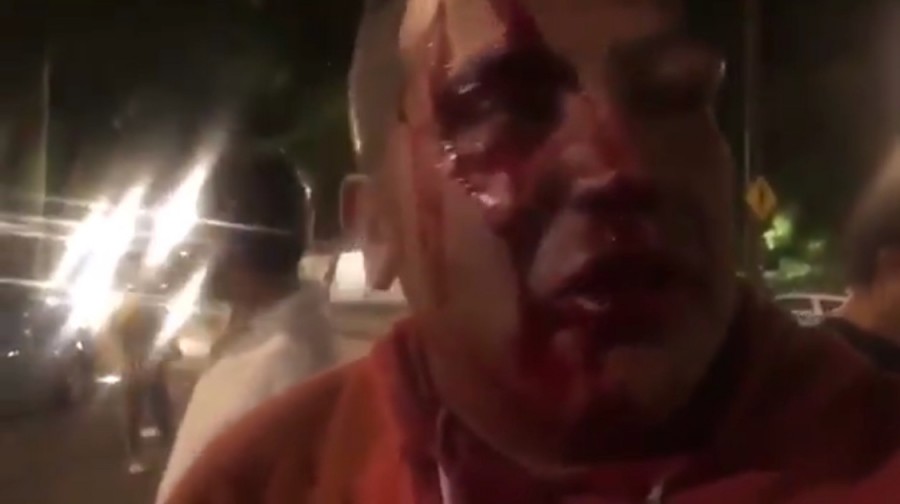 Policías golpean y roban equipo a periodistas de la CDMX