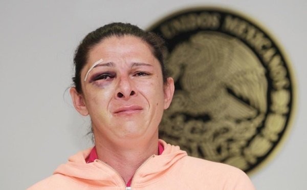 Sospechan que el golpeador de Ana Guevara es policía