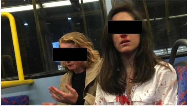 Golpean a mujeres por negarse a besarse en público